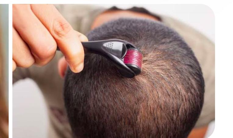 Derma roller product and support visual